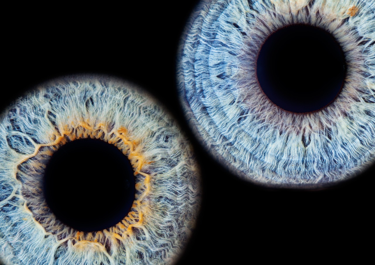 Iridology Canberra